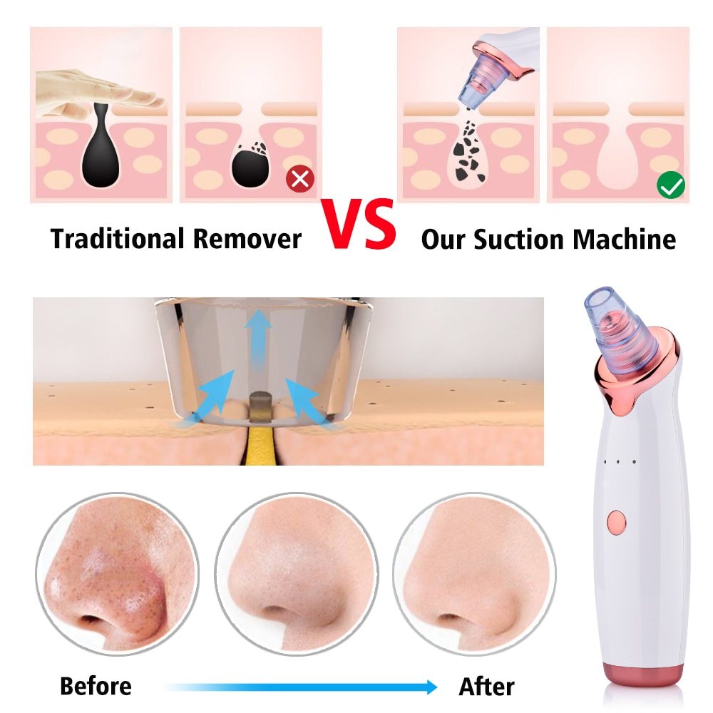 Blackhead Instrument Electric Suction Facial Washing